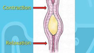 Swallowing Disorders and Achalasia [upl. by Senskell]