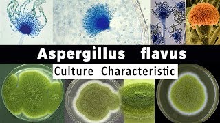 Aspergillus Flavus Culture Characteristic [upl. by Nealson]