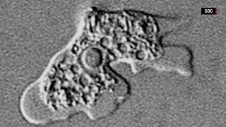 How dangerous are brain eating amoeba [upl. by Hare]