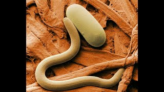 What are nematodes [upl. by Eriha]