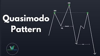 Quasimodo pattern  SMC [upl. by Linnie814]