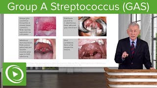 Group A Streptococcus GAS – Infectious Diseases  Lecturio [upl. by Mindi]