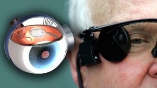 Bionic Eye Cures Blindness [upl. by Sigmund]