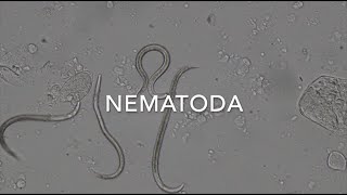 Nematodes [upl. by Nosoj]