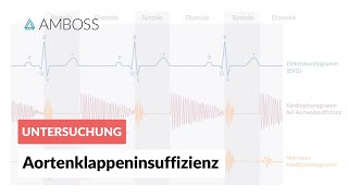 Aortenklappeninsuffizienz  Herzgeräusch  AMBOSS Video [upl. by Flowers]