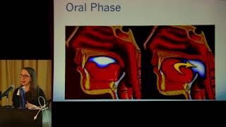 Making Connections Swallowing Therapy and the SLP [upl. by Armstrong246]