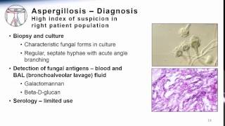 Aspergillosis [upl. by Shah]