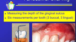 Charting Sequence and Periodontal Charting [upl. by Itoyj815]