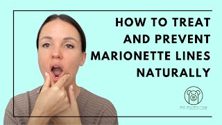 How to treat and prevent Marionette Lines naturally [upl. by Linders]