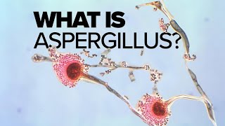 What is Aspergillus mold [upl. by Ycinuq]