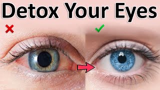 How To Make Your Eyes Clean And Clear [upl. by Eittik]