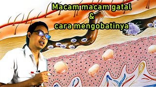 Penyebab amp Obat Gatal Pada Kulit Yang Ampuh  Urtikaria Scabies Herpes Dermatitis Jamur [upl. by Salim44]