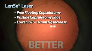 Concepts in refractive surgery Part 4 [upl. by Llertnac]