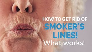 How to remove smokers lines update [upl. by Shaine166]