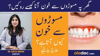 Masudo Se Blood Aane Ka Ilaj  Gums Bleeding Treatment In Urdu Danto Se Khoon Ane Ka Wajah Aur Ilaj [upl. by Mullane723]