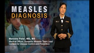 Measles Diagnosis [upl. by Farrel]