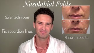 Nasolabial Folds amp Accordion Lines A Tutorial [upl. by Aener]