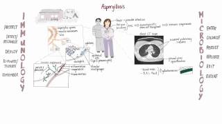 Aspergillus Springboard [upl. by Livy162]