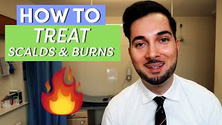 How to treat a burn [upl. by Alehs]