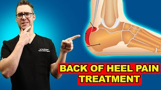 Heel Bursitis  Causes and Treatment [upl. by Genet]