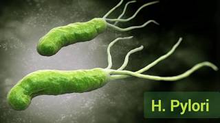 Helicobacter pylori gastritis Pathogenesis and morphology [upl. by Ahsets]