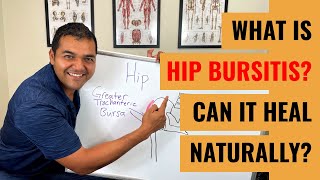 Top 3 Exercises For Trochanteric Hip Bursitis [upl. by Vincents]