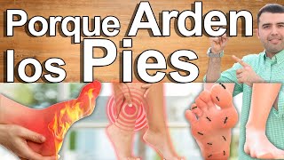 Porqué Me Arden Los Pies  Causas Y Soluciones Para El Ardor Y Dolor En Los Pies [upl. by Elsinore80]