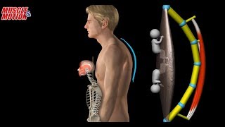 Myofacia approach for forwardhead posture [upl. by Bilak]