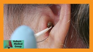 How Do Hearing Aids Work Video [upl. by Surad]