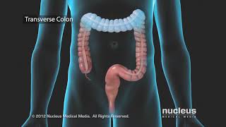 Virtual Diverticulitis Surgery Consultation  Dr Joshua Taylor MD FACS  The Surgical Clinic [upl. by Einnim]