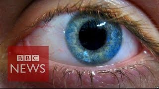 Stem cell cure for blindness tested  BBC News [upl. by Arondel769]