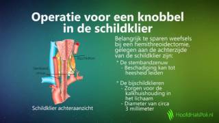 Knobbel in de schildklier [upl. by Wane989]