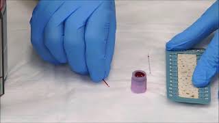 How to Measure the Hematocrit [upl. by Arlene289]