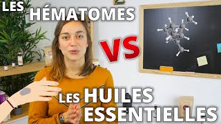 HÉMATOMES Remède naturel aux huiles essentielles [upl. by Percival]