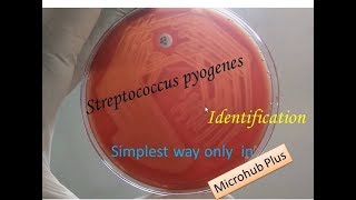 Streptococcus pyogenes identification [upl. by Yoong]