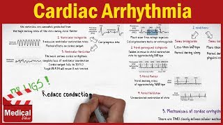 Pharmacology  Cardiac Arrhythmia and Antiarrhythmic Drugs FROM A TO Z [upl. by Sayres]