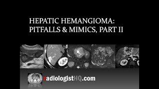 Hepatic Hemangioma Pitfalls amp Mimics Part II [upl. by Aizek]