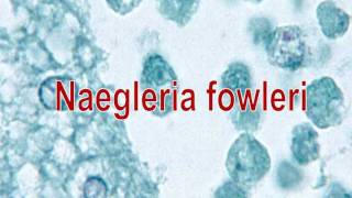 Naegleria fowleri [upl. by Ande]