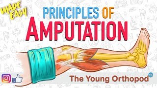 Amputation Principles  ANIMATION  BASICS  NEET PG  Amputee  The Young Orthopod [upl. by Boice]