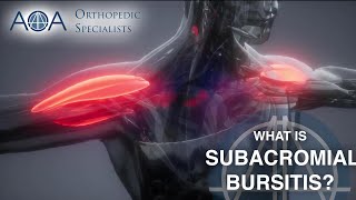 What is Shoulder Bursitis [upl. by Dola]