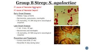 Group B Streptococcus GBS [upl. by Atiugal]